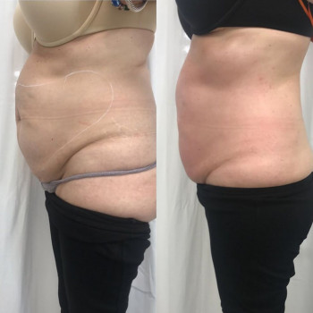 Юлия Мартиненко, Киев Фото - 11