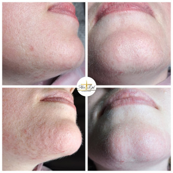 Альона Кушнір, Вышгород Фото - 12