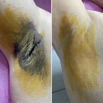 Ольга Закусіло, Київ Фото - 5