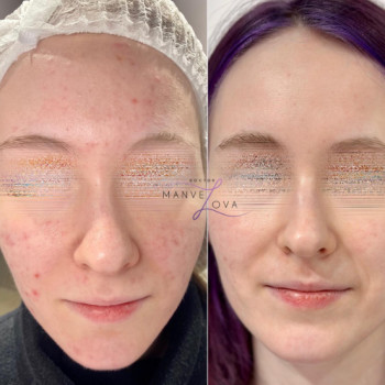 Карине Манвелова, Киев Фото - 5