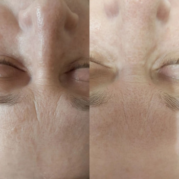 Ольга Сеніна, Київ Фото - 5