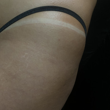 Миттєва засмага
                    Косметолог  Вінниця