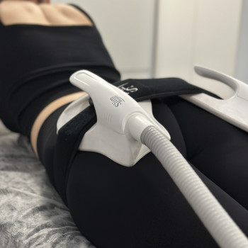 Електромагнітна стимуляція мʼязів