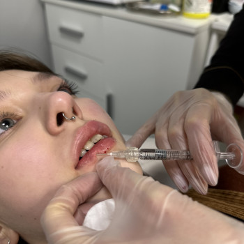 LazerPro100, Белая Церковь Фото - 2