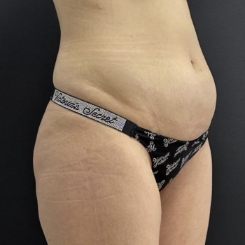 Абдель Эрритали, Харків Фото - 27