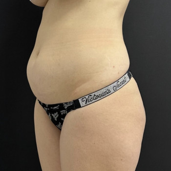 Абдель Эрритали, Харків Фото - 26