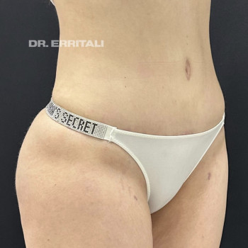 Абдель Эрритали, Харків Фото - 28