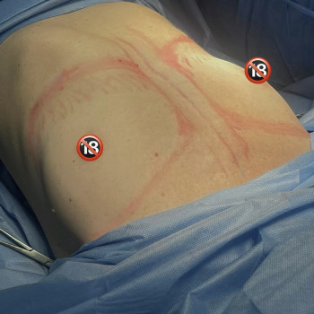 Абдель Эрритали, Харків Фото - 29