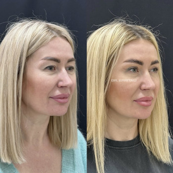 Абдель Эрритали, Харків Фото - 32