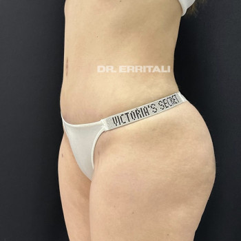 Абдель Эрритали, Харків Фото - 33