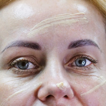уход за лицом, косметология лица