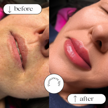 Фото до та після
Пудрове напилення губ