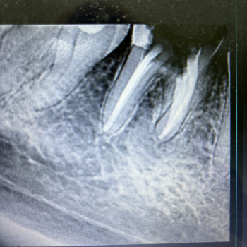 Артем Галамай, Львов Фото - 8