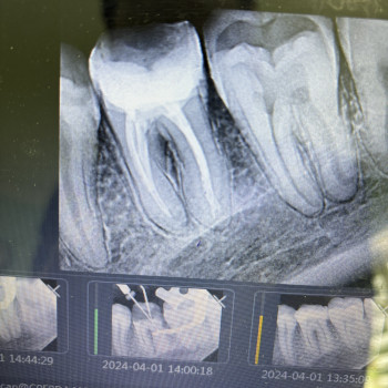 Артем Галамай, Львов Фото - 9