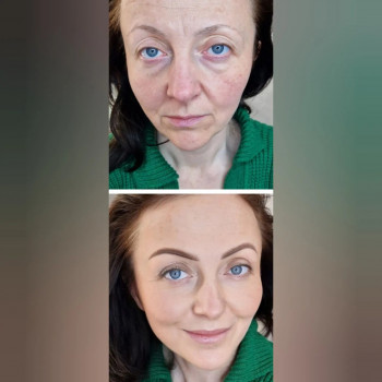 Татьяна Казановская, Киев Фото - 5