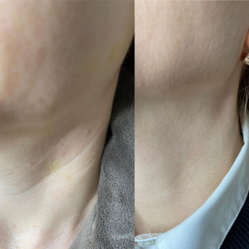 Галина Чухань, Львів Фото - 5