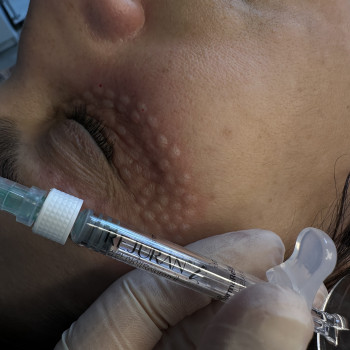 Елена Майорова, Харьков Фото - 18