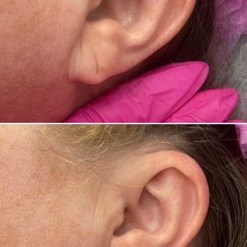 Ирина Заскока, Львов Фото - 5