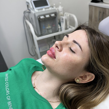 Контурна пластика губ і підборіддя