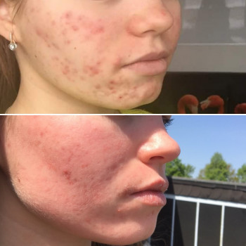 Лілія Бугель, Львів Фото - 5