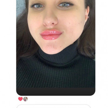 Фотовідгук #