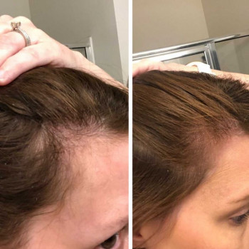 Фото из портфолио косметолога Орина Гінова (Черкассы)