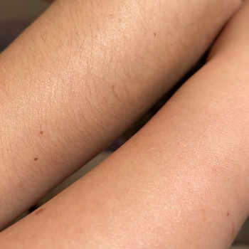  #воскова_депіляція #ваксинг #віск #видалення_волосся #бориспіль