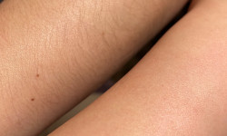 Воскова депіляція Бориспіль Майстер воскової депіляції  Бориспіль