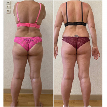 Vitality, Ирпень Фото - 19