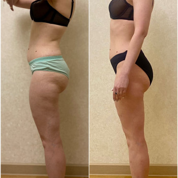 Vitality, Ирпень Фото - 22