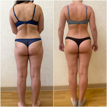 Vitality, Ирпень Фото - 23