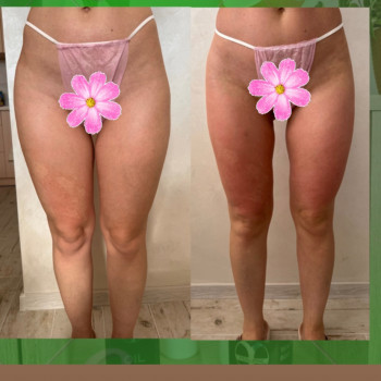 Олена Захарченко, Одеса Фото - 80