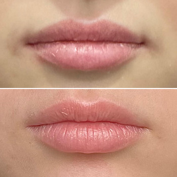 Medestet, Львів Фото - 5