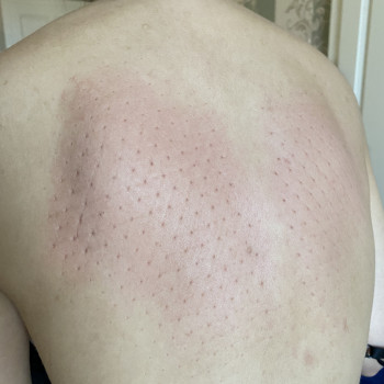 Олексій Косовськи, Мукачево Фото - 5