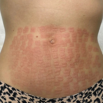 Анна Герасименко, Одеса Фото - 5