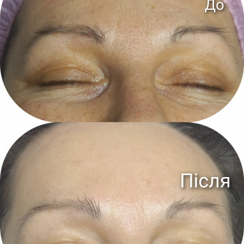 Догляд за обличчям Renew+пластифікуючий масаж обличчя
 
 
 