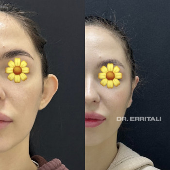 Абдель Эрритали, Харків Фото - 24