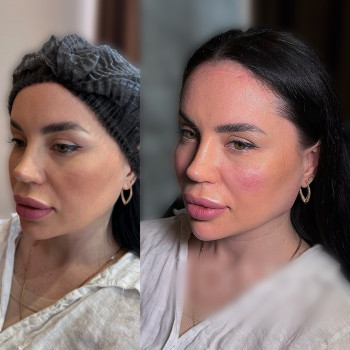 Марина Тенетюх, Тернопіль Фото - 4