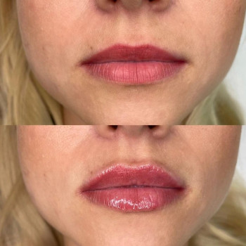 Олександра Захарова, Одеса Фото - 5