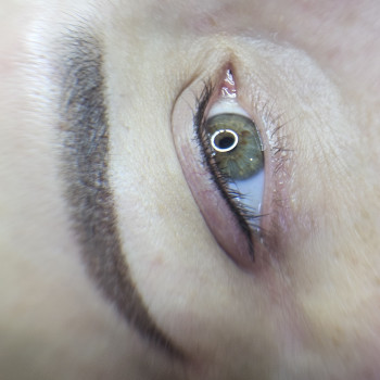 Міжвійка з маленьким виходом 
 