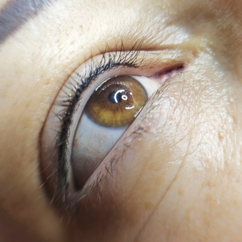 Межресничка 
 