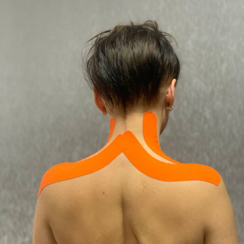 тейпування