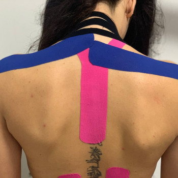 тейпування