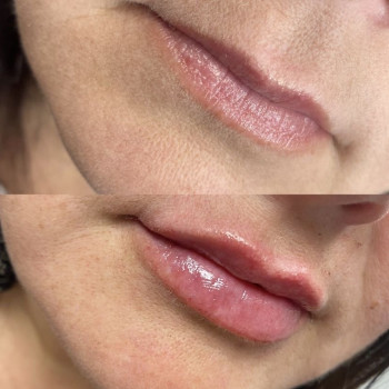 Альона Коляда, Київ Фото - 15