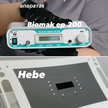 Електро Епіляція
                    Електролог Наталя Хмельницький