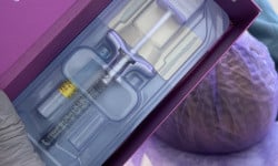 Збільшення губ філлером Juvederm Ultra 3 філлер на основі гіалуронової кислоти з лідокаїном Косметолог-инъекционист Наталия Киев