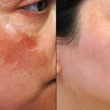 Альона Коляда, Київ Фото - 7