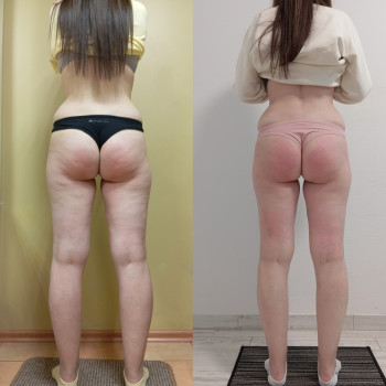 Анна Юрьєва, Одеса Фото - 47