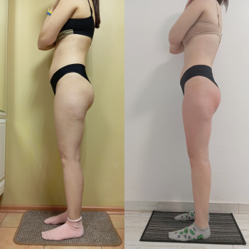 Анна Юрьєва, Одеса Фото - 43