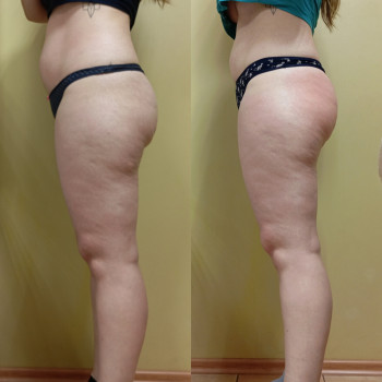 Анна Юрьєва, Одеса Фото - 40